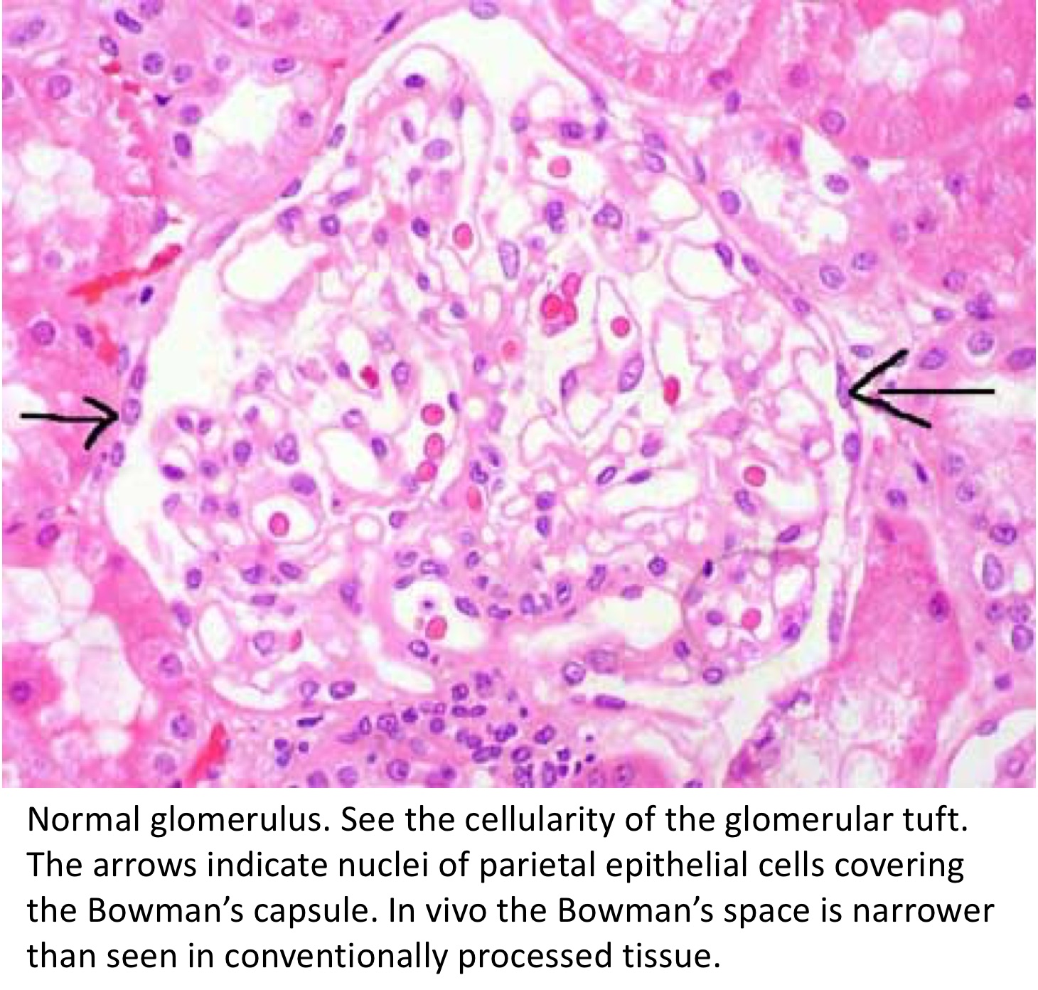 Normal-glomerulus